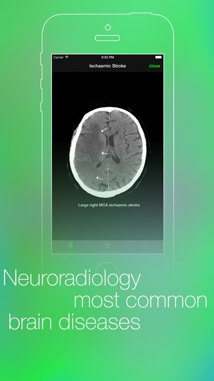 iRadiologist - Brain