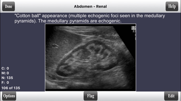 ARDMS OBGYN + Abdomen + SPI Ultrasound Flashcards