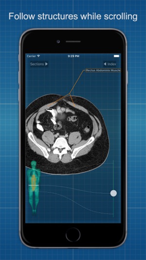 X-Anatomy Pro(圖3)-速報App