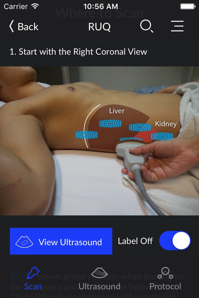 RESUS Ultrasound screenshot 2