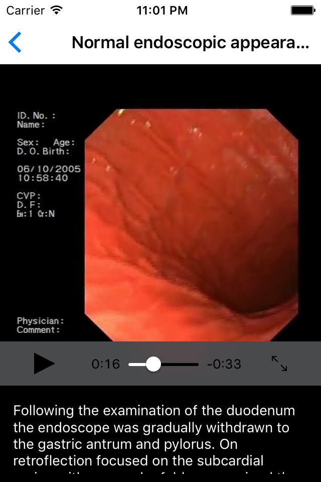 ENDO3® Atlas of Gastrointestinal Endoscopy - Lite screenshot 4