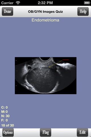 ARDMS OBGYN Ultrasound Flashcards for ARDMS OB/GYN Board Review screenshot 2