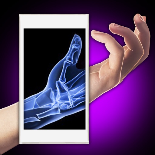 Xray Fracture Hand Prank iOS App