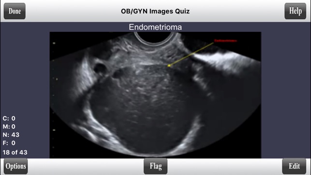 ARDMS OBGYN Ultrasound Flashcards for ARDMS OB/GYN Board Rev(圖2)-速報App