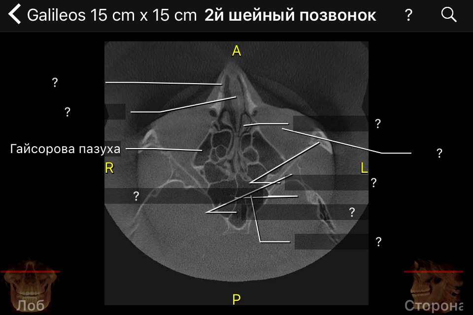 CBCT screenshot 4