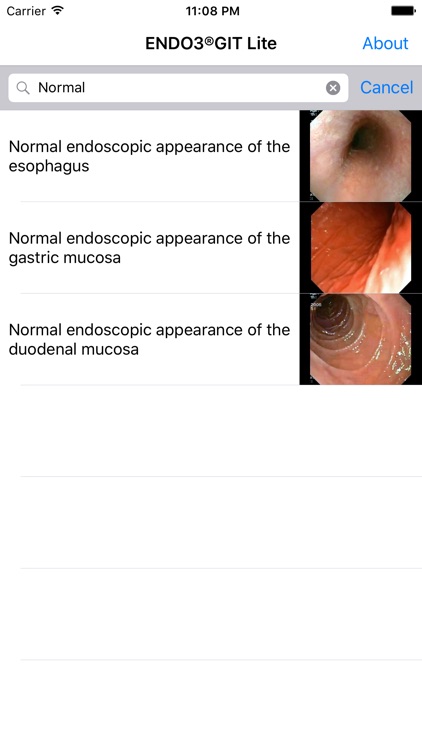 ENDO3® Atlas of Gastrointestinal Endoscopy - Lite