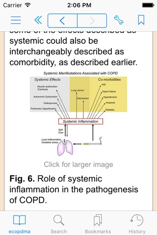 Chronic Obstructive Pulmonary Disease: A Multidisciplinary Approach, 1e (Clinics Collections) screenshot 3