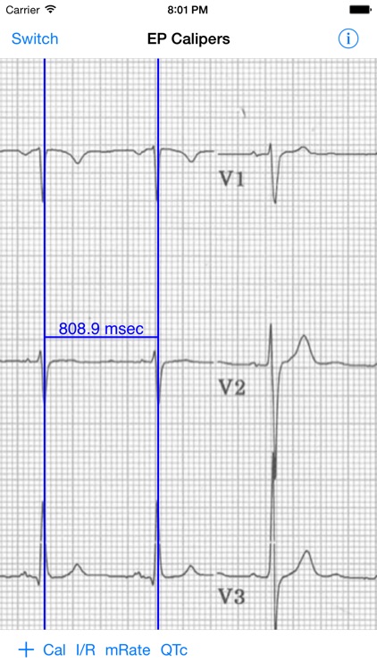 EP Calipers screenshot-3