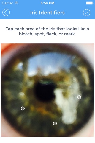 Iridology Test screenshot 3