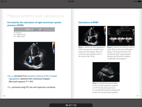 Ultrasound POC Education - Philips screenshot 3