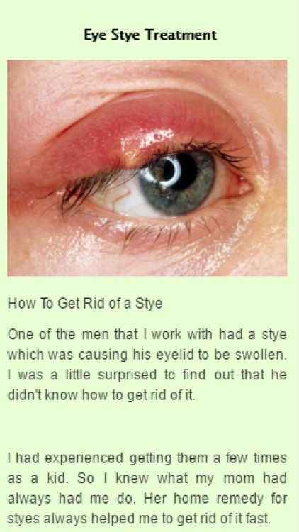 How To Get Rid Of A Stye By Globalappz 