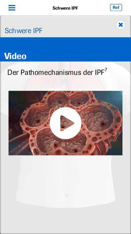 Roche IPF screenshot-3