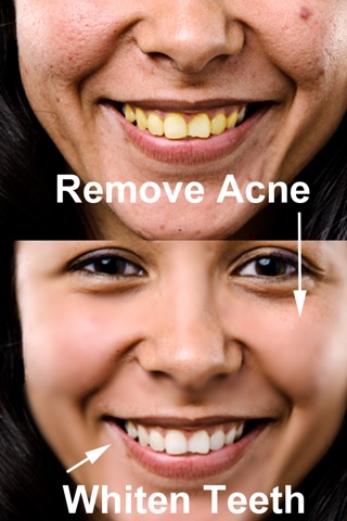 Clear Skin - Remove Acne, Whiten Teeth, and Crop Photos screenshot 4