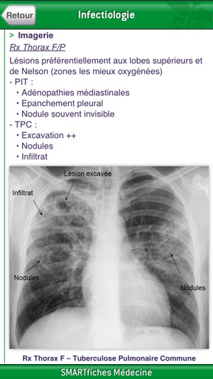 SMARTfiches Infectiologie Free(圖2)-速報App