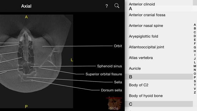 CBCT(圖4)-速報App