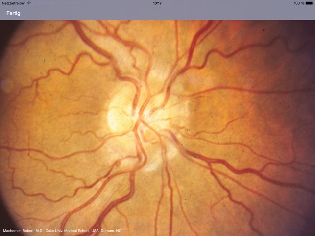 Atlas of Ophthalmology HD by Onjoph(圖4)-速報App