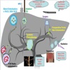 Barcelona Clinic Liver Cancer (BCLC) Classification