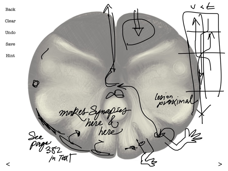 Brainstem101 - Neuroanatomy of the Human Brainstem screenshot-3