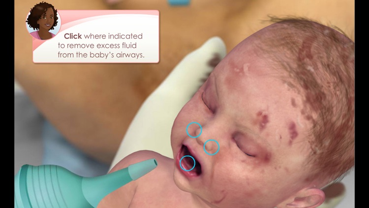 Child Birth with Epidural