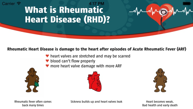 RHD Genetics - Menzies School Of Health Research