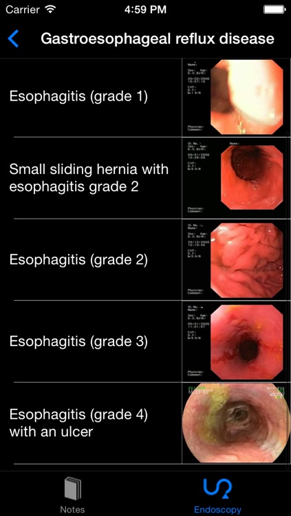 ENDO3® Atlas of Gastrointestinal Endoscopy