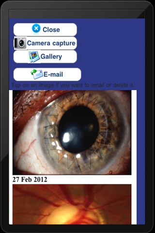 eyePatientsMobile screenshot 2