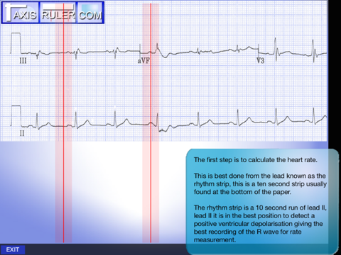 ECG Genius screenshot 4