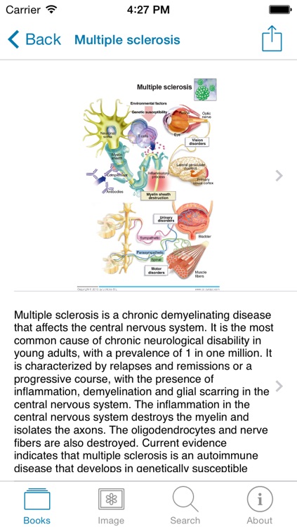 Miniatlas Central Nervous System screenshot-4