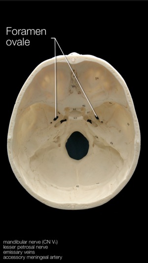 Skull Osteology(圖3)-速報App