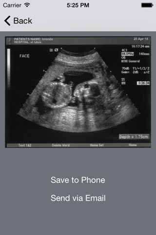 ultrasound-spoof screenshot 2