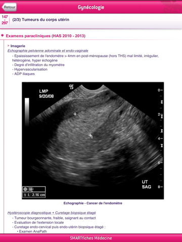 SMARTfiches Gynécologie Freeのおすすめ画像3