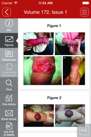 British Journal of Dermatology screenshot 4