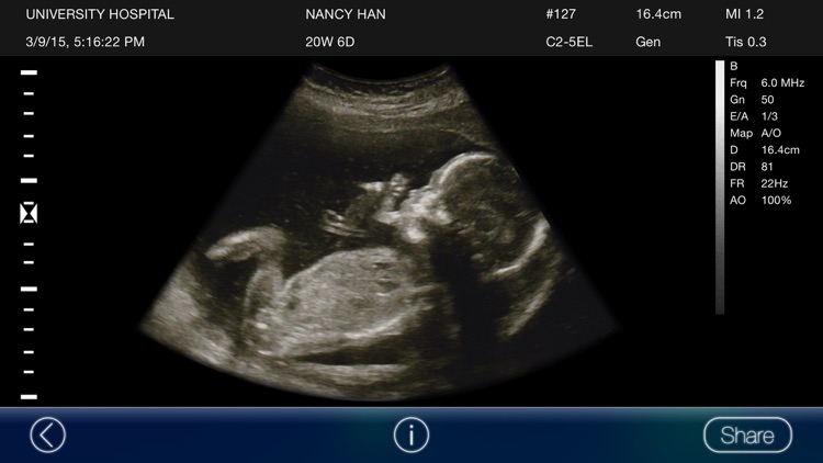 Mom, I'm pregnant - Ultrasound Prank