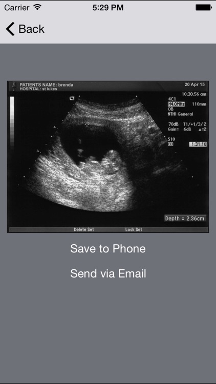 ultrasound-spoof