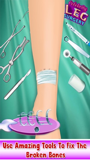 Celebrity Leg Doctor Surgery Free(圖2)-速報App