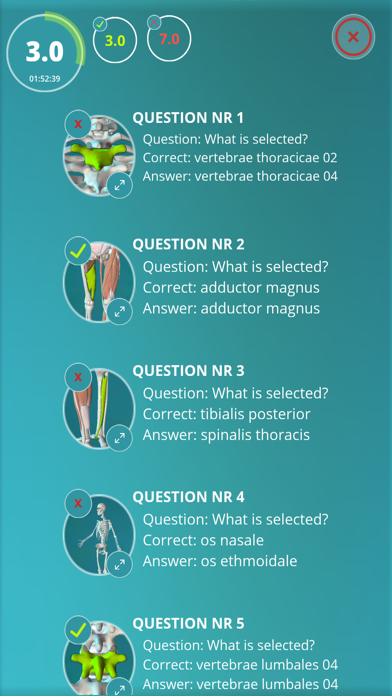 How to cancel & delete Anatomy Quiz - muscles and bones from iphone & ipad 4