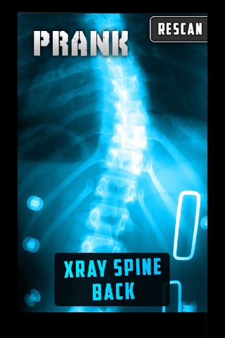 Simulator X-Ray Spine Back screenshot 2