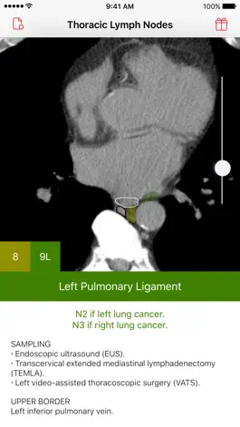 Game screenshot Thoracic Lymph Node Map mod apk