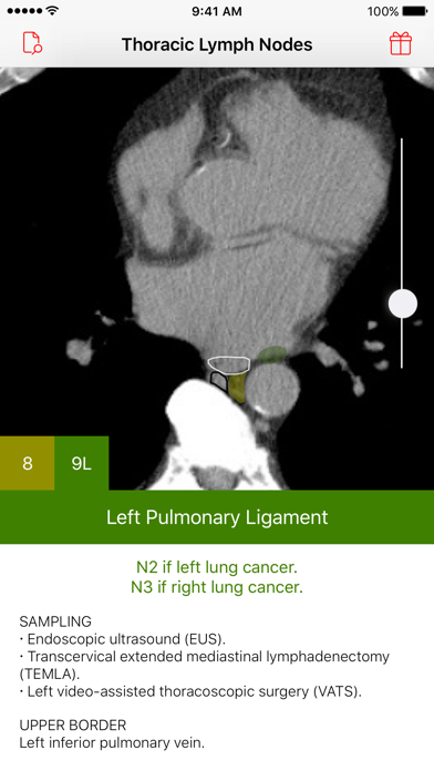 How to cancel & delete Thoracic Lymph Node Map from iphone & ipad 1