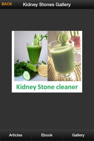 Kidney Stones Guide - How To Prevent & Treat Kidney Stones Symptoms screenshot 4