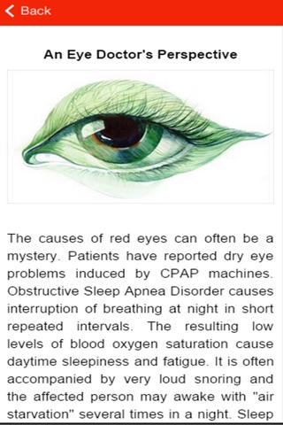 Dry Eye Symptoms & Remedies screenshot 2