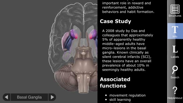 3D Brain(圖3)-速報App