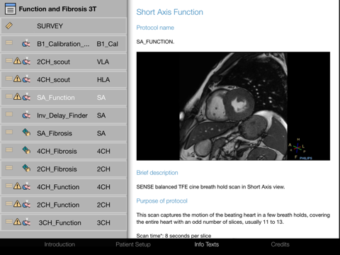 Cardiac MRI - Function & Fibrosis Imaging screenshot 2