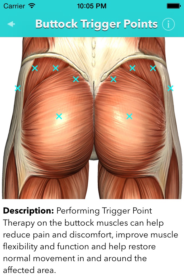 My Trigger Points screenshot 4