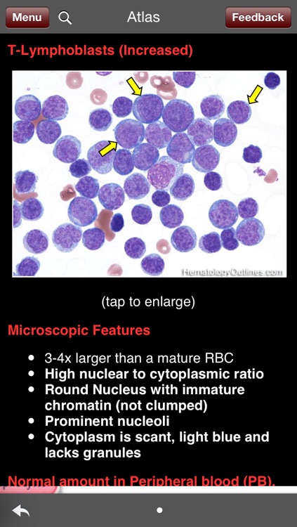 Hematology Outlines: HH Rashidi MD & JC Nguyen MD screenshot-4