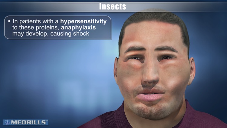 Medrills: Bite and Sting Emergencies screenshot-3