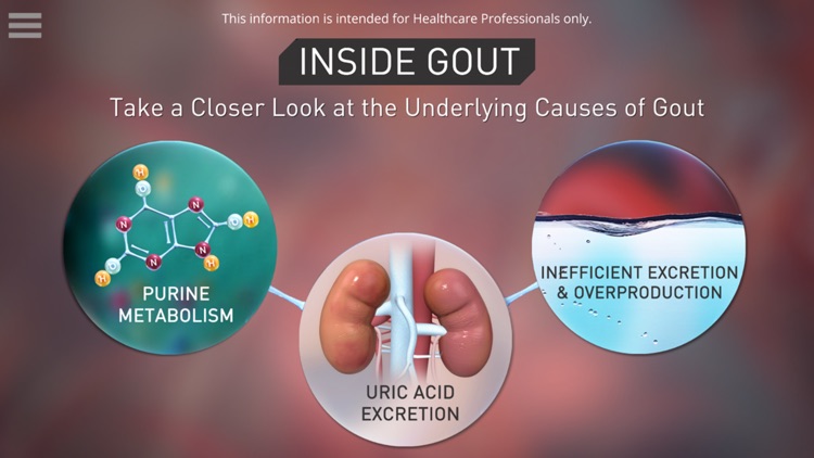 Inside Gout