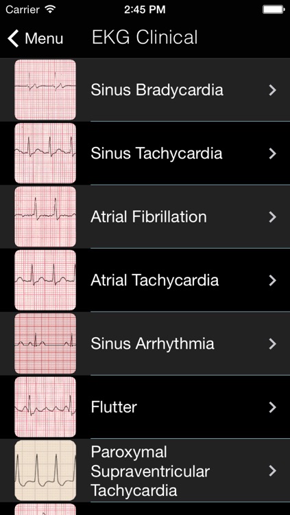 EKG Clínico