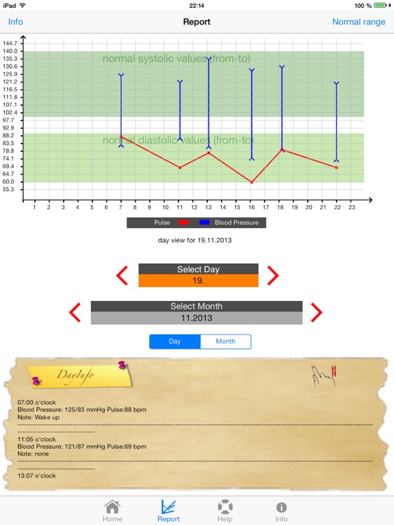 BloodPressure+Pulse Grapher Lite 2.0 (iPad-version)