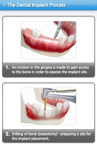 MegagenImplant. screenshot 3